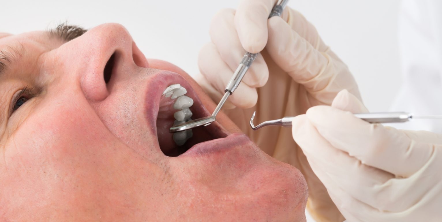 Oral rehabilitation