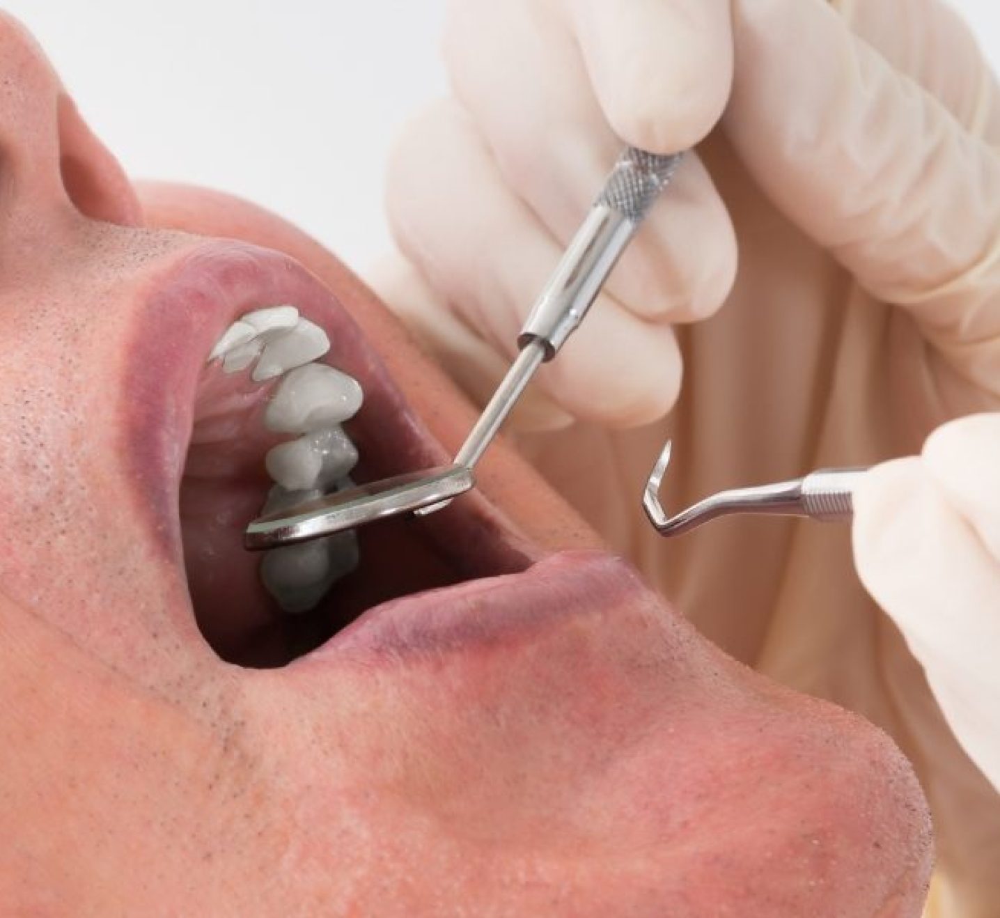 Oral rehabilitation