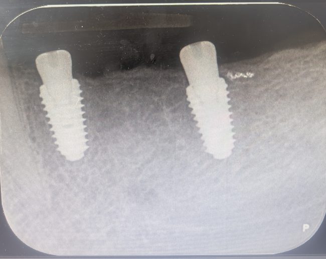 Knightsfield Dental Practice